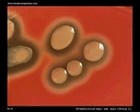 beta hemolysis